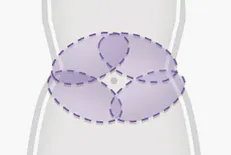 REAL冷冻溶脂术敷贴器 3