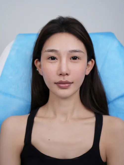 项目影像参考 2