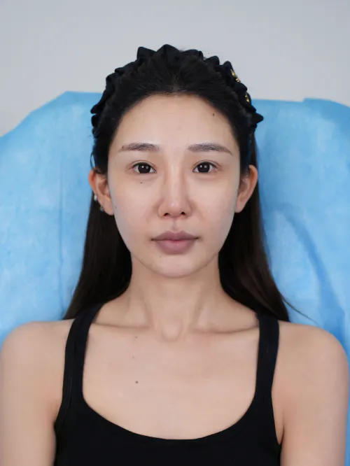 项目影像参考 1
