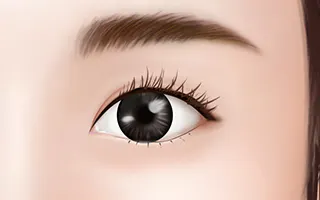 双眼皮手术方法 1