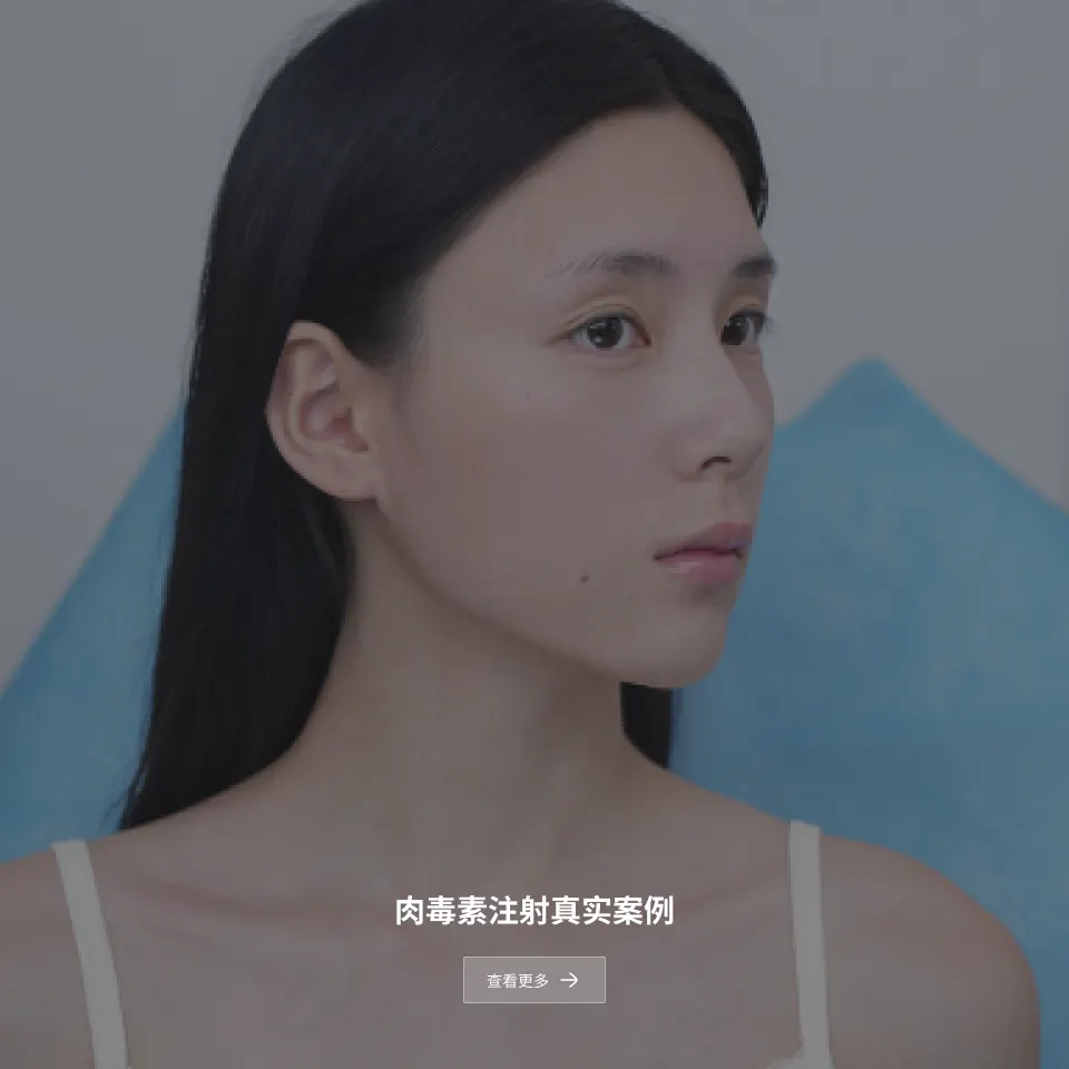 肉毒素注射后记 2