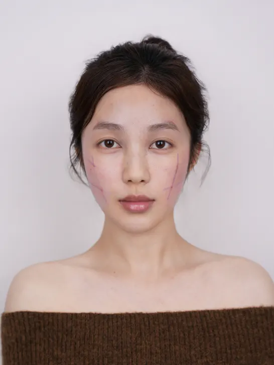 项目影像参考 10