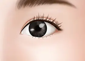 如果你有严重的黑眼圈 4