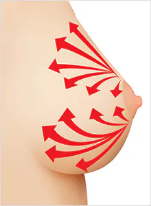 全面、均匀、精细的注入 · 项目影像参考 03