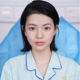 开眼角手术后记 1