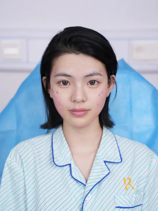 项目影像参考 1