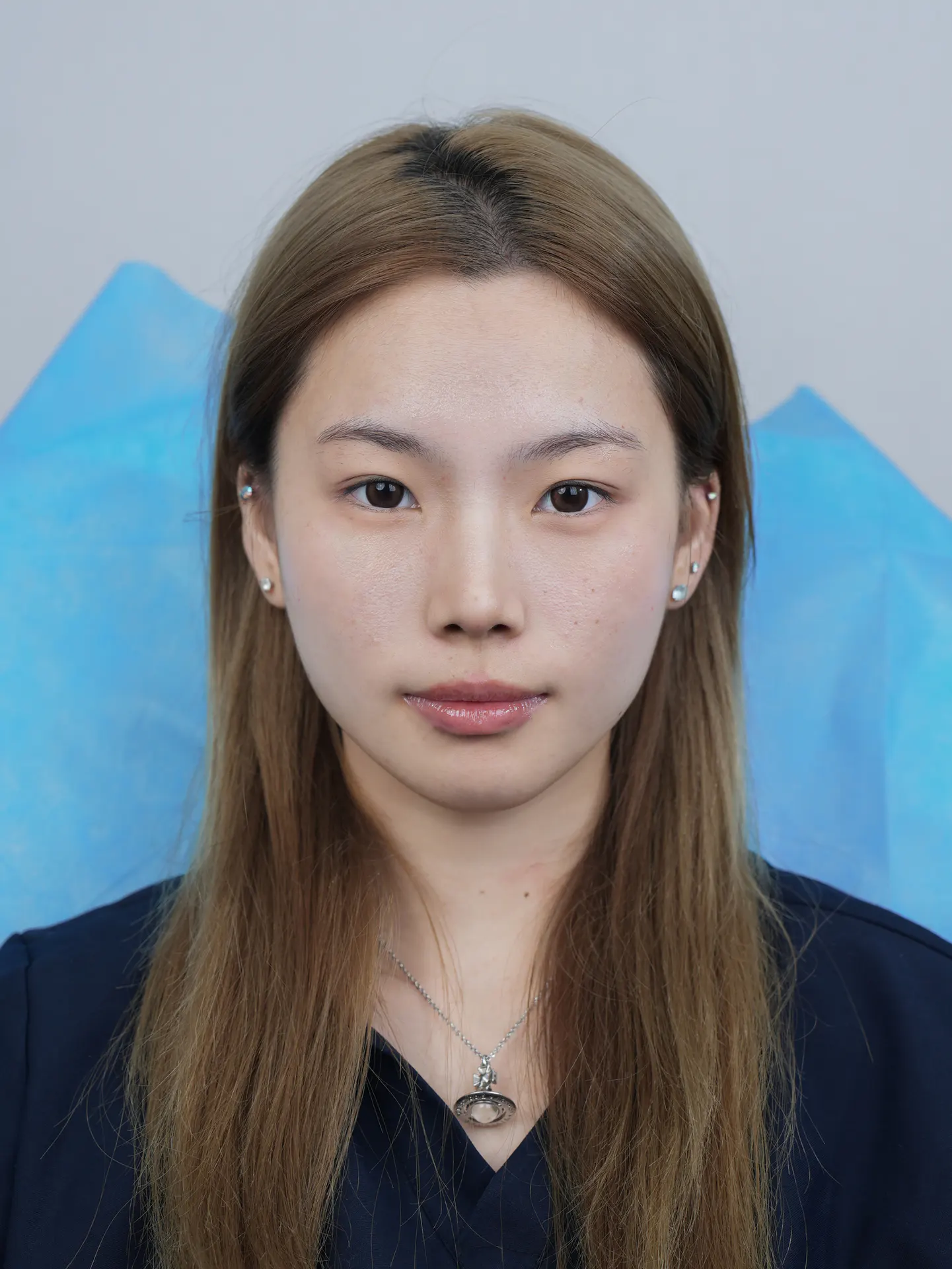 眼部手术后记 2