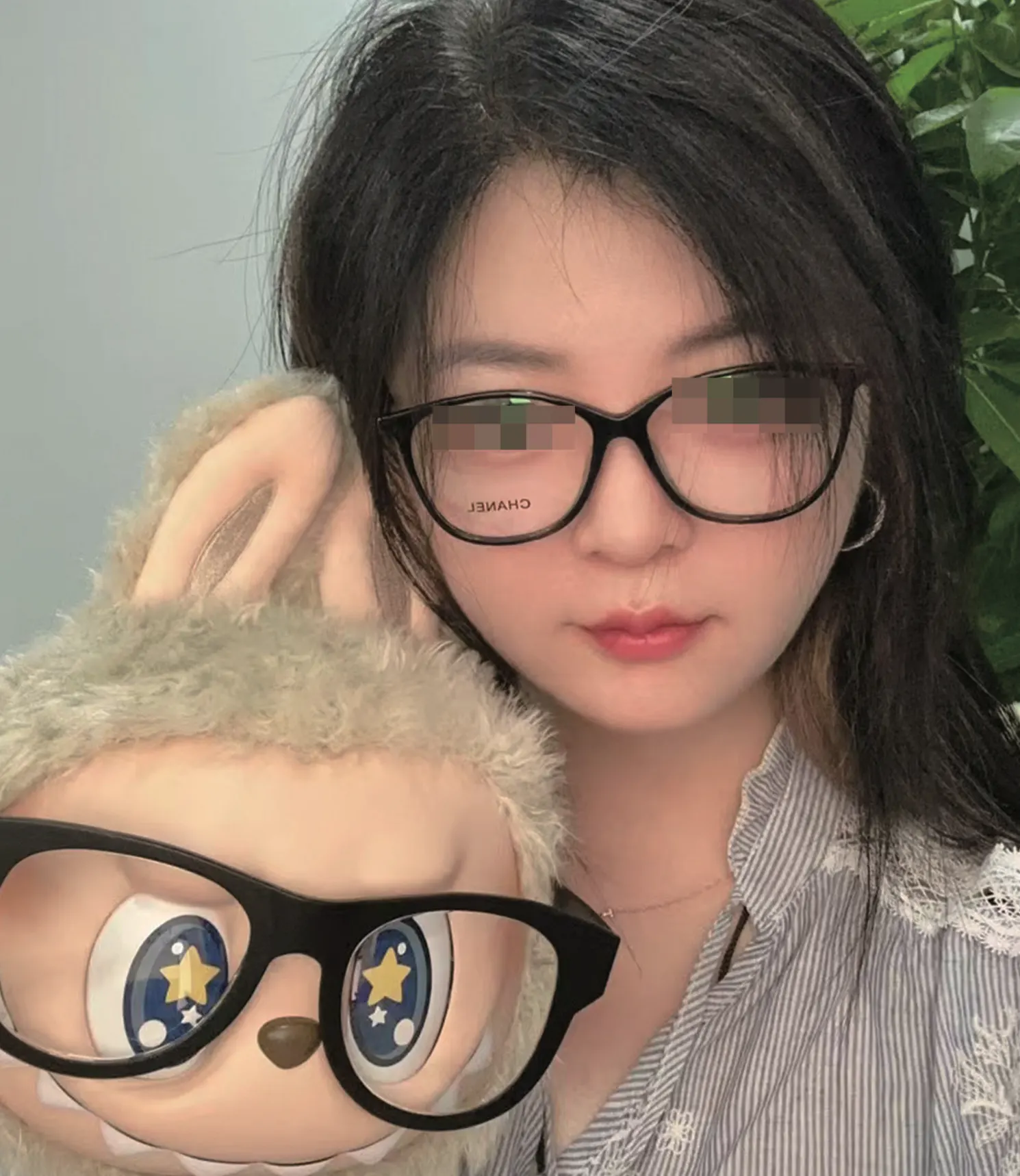 Facial liposuction 9